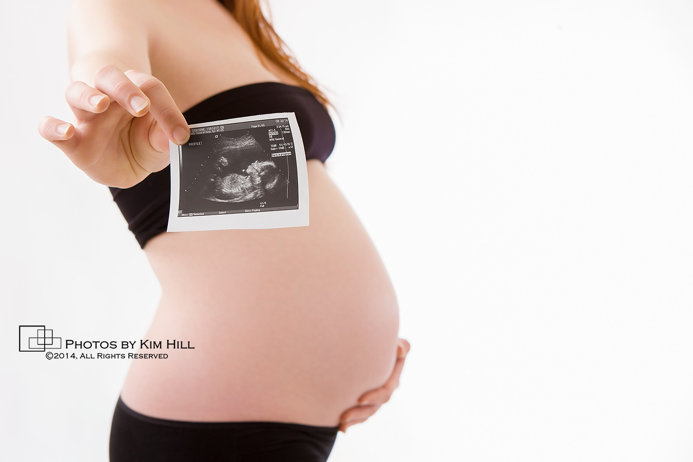 Pregnancy Sonogram Photo
